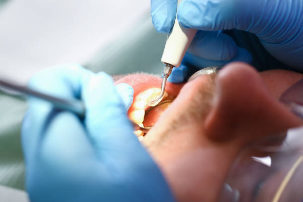 Best Emergency Treatment for Toothache in Anderson, IN